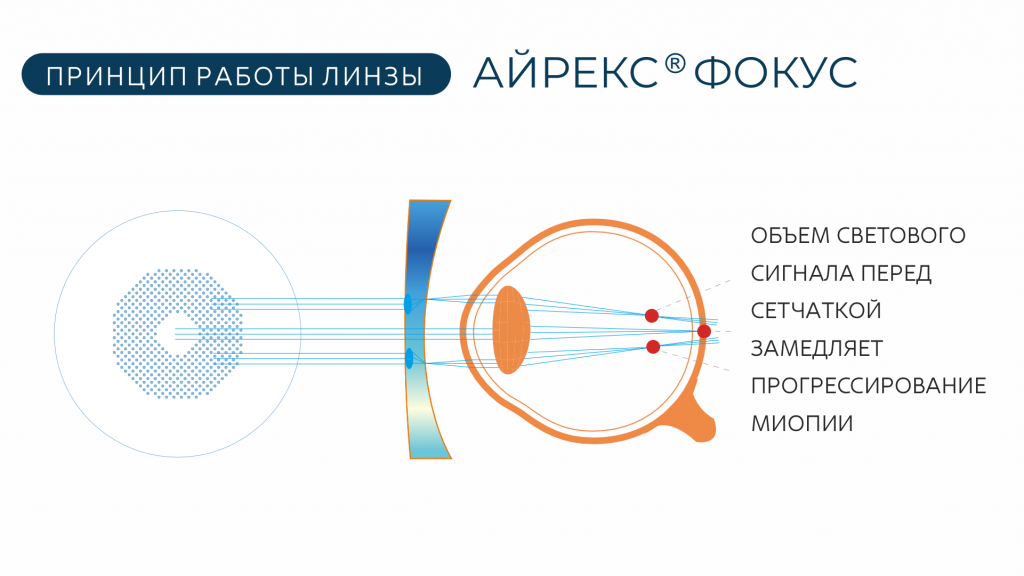 айрекс фокус сайт разделы 6.png